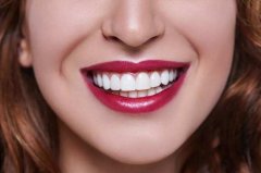 牙齿美学修复真的适合你吗？