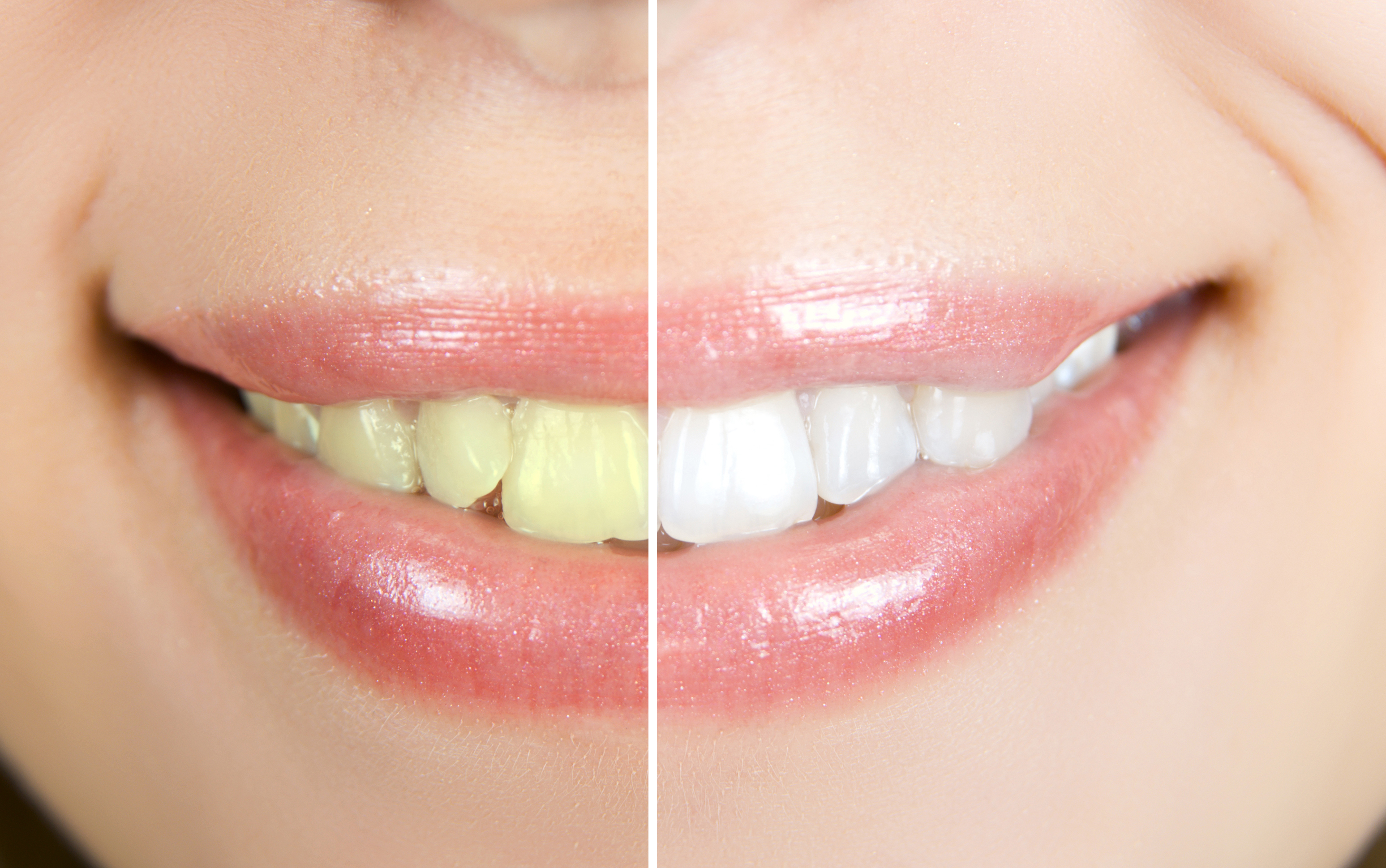 牙齿为什么会越来越黄？