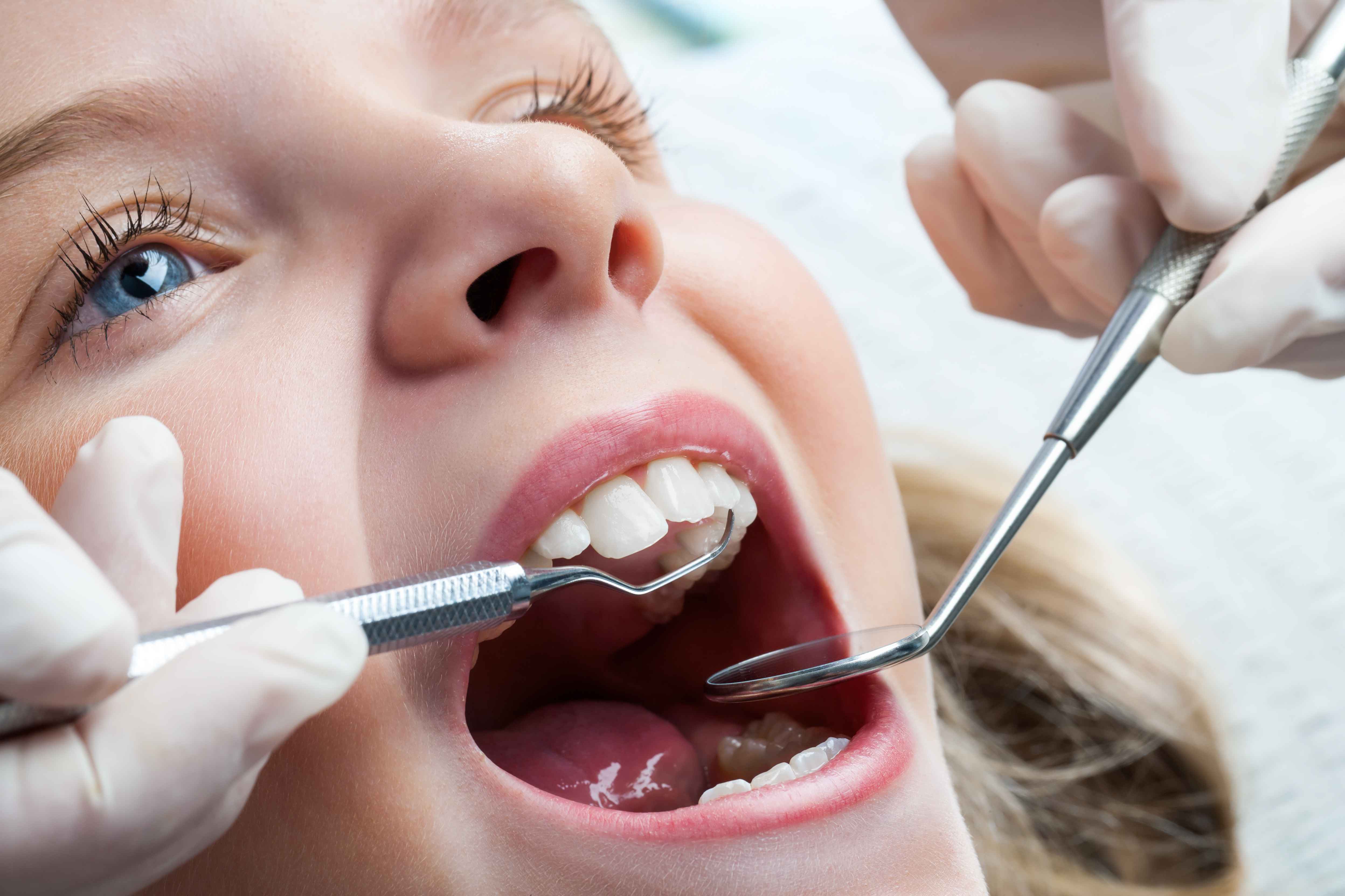 哪些牙齿疾病需要做根管治疗？